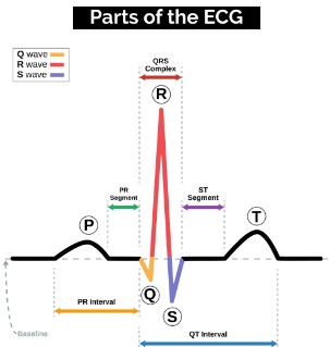 راهنمای جامع انواع دستگاه نوار قلب (ECG) و نحوه تفسیر آن