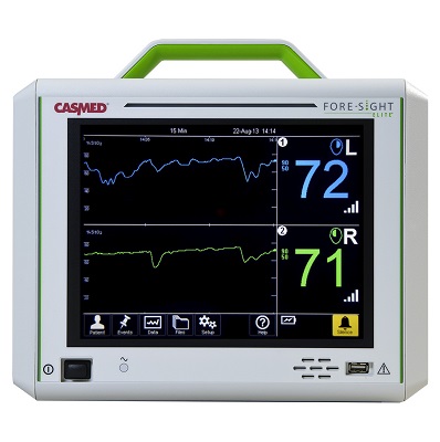 دستگاه اکسی متر مغزی مدل Regional Oximetry