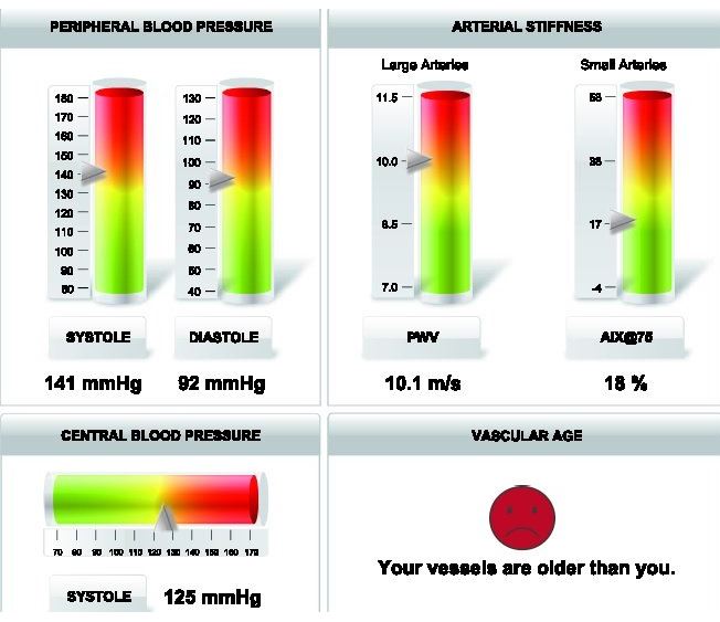 دستگاه هولتر فشار خون مدل سیستم PWA | می مد
