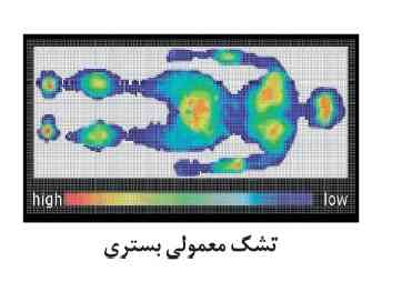 تشک فومی حافظه دار ضد زخم بستر آریانا مدل بیماران ریسک بالا و پایین ARIA-Pro