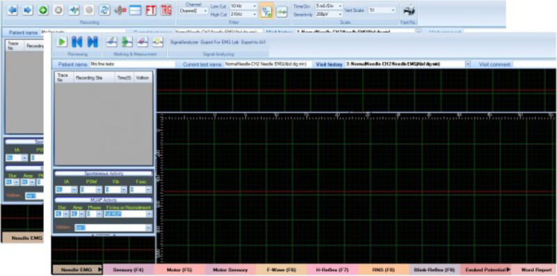 دستگاه EMG مدل NCV/EP 5000Q | می مد