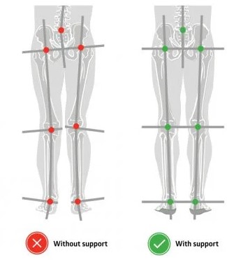 دستگاه آنالیز قامت (پاسچر گرافی) مدل PT-POSTURE | می مد