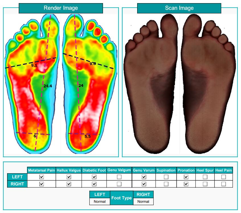 اسکنر دو بعدی کف پا مدل PT-2D SCAN