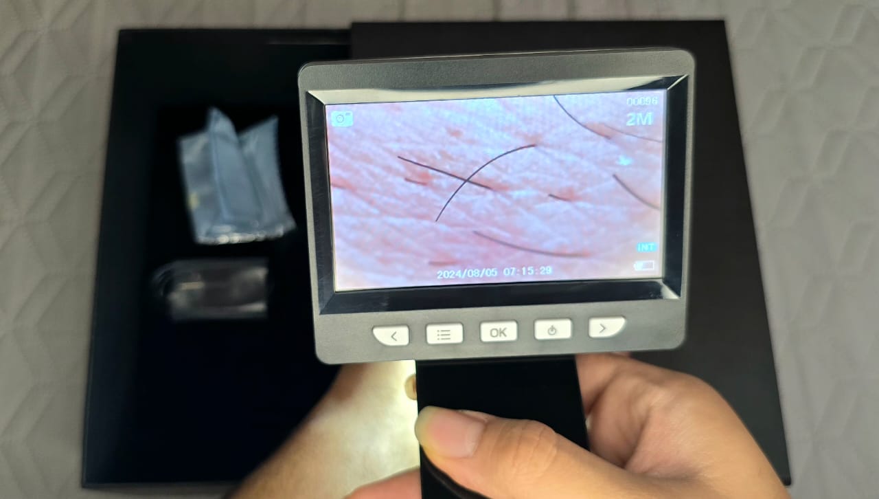 درماتوسکوپ دیجیتال مای Mai | می مد