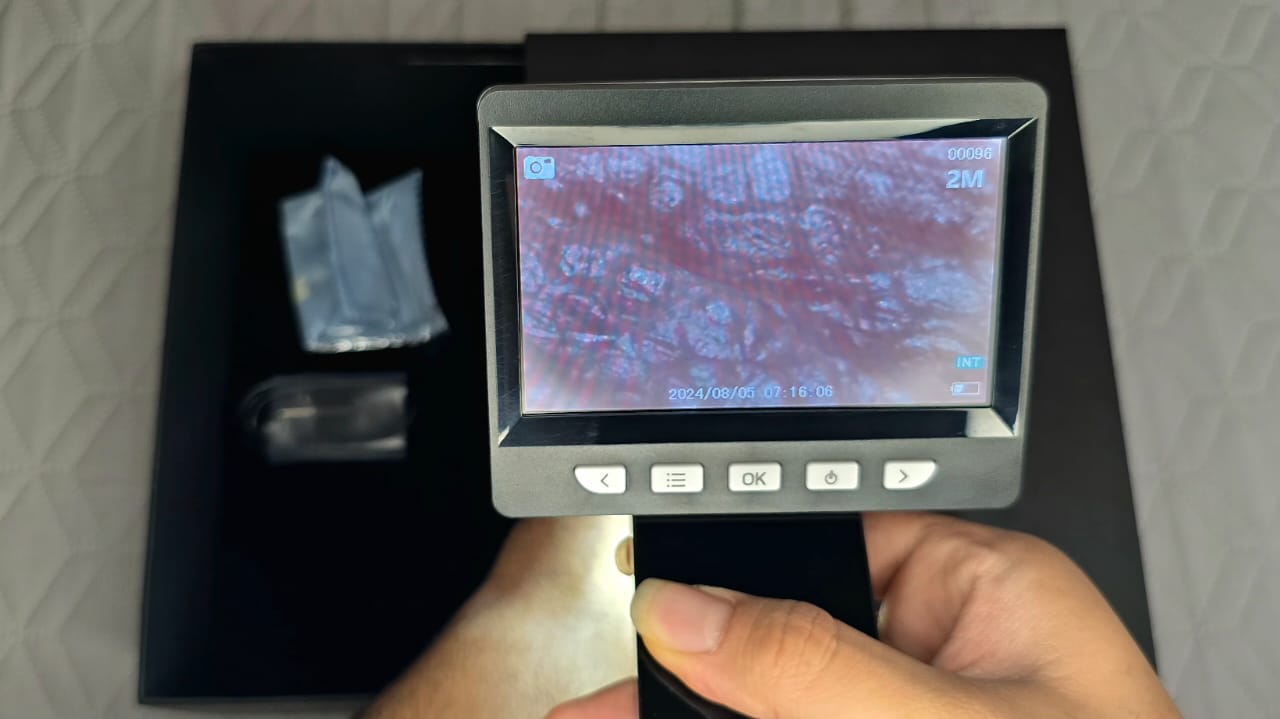 درماتوسکوپ دیجیتال مای Mai | می مد